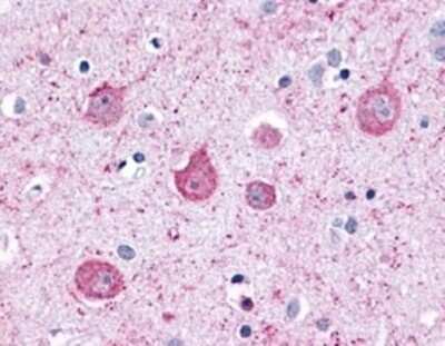 Immunohistochemistry-Paraffin: Latrophilin 2/LPHN2 Antibody - BSA Free [NLS1136]