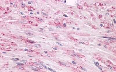 Immunohistochemistry-Paraffin: Latrophilin 2/LPHN2 Antibody - BSA Free [NLS1136]