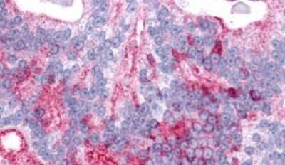 Immunohistochemistry-Paraffin: Latrophilin 2/LPHN2 Antibody - BSA Free [NLS1136]