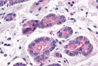 Immunohistochemistry-Paraffin: Latrophilin 2/LPHN2 Antibody - BSA Free [NLS1136]