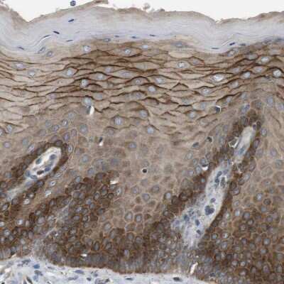 Immunohistochemistry-Paraffin: Latrophilin 3/LPHN3 Antibody [NBP1-82962]