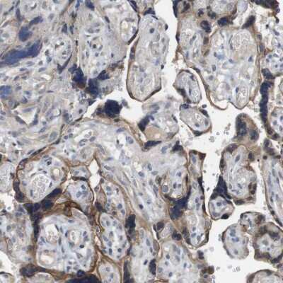 Immunohistochemistry-Paraffin: Latrophilin 3/LPHN3 Antibody [NBP1-82962]