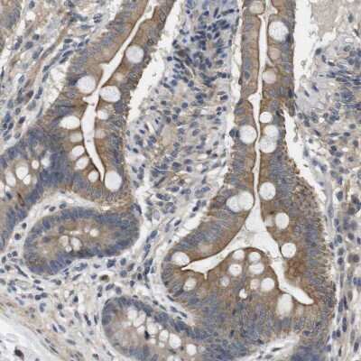 Immunohistochemistry-Paraffin: Latrophilin 3/LPHN3 Antibody [NBP1-82962]