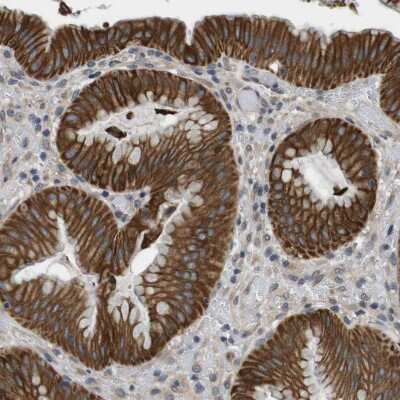 Immunohistochemistry-Paraffin: Latrophilin 3/LPHN3 Antibody [NBP1-82962]