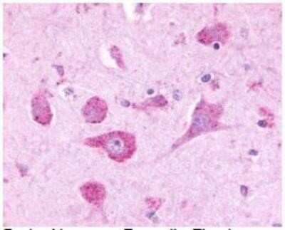 Immunohistochemistry-Paraffin: Latrophilin 3/LPHN3 Antibody - BSA Free [NLS1138]