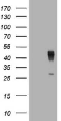 Western Blot: Layilin Antibody (OTI4D3) [NBP2-45613]