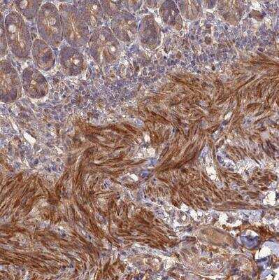 Immunohistochemistry-Paraffin: Layilin Antibody [NBP1-83541]