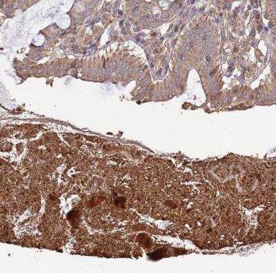 Immunohistochemistry-Paraffin: Layilin Antibody [NBP1-83541]