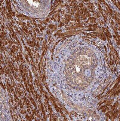 Immunohistochemistry-Paraffin: Layilin Antibody [NBP1-83541]