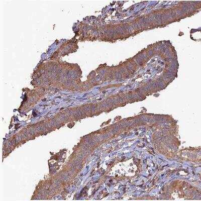 Immunohistochemistry-Paraffin: Layilin Antibody [NBP1-83541]