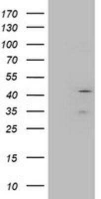 Western Blot: Layilin Antibody (OTI4C11)Azide and BSA Free [NBP2-72402]