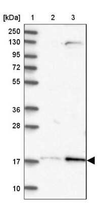 Western Blot: Layilin Antibody [NBP1-83541]