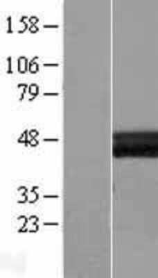 Western Blot: Layilin Overexpression Lysate [NBL1-12450]