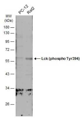 Western Blot: Lck [p Tyr394] Antibody [NBP3-13305]