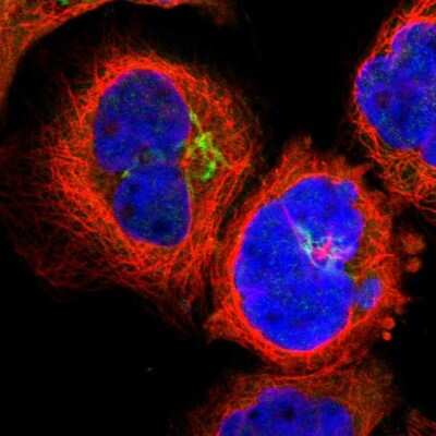 Immunocytochemistry/ Immunofluorescence: Lck Antibody [NBP1-85804]