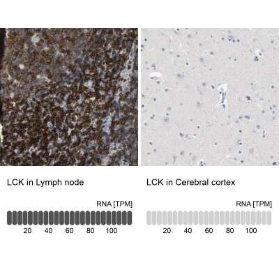 Immunohistochemistry-Paraffin: Lck Antibody [NBP1-85804]