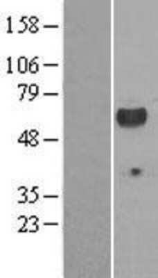 Western Blot: Lck Overexpression Lysate [NBP2-09247]