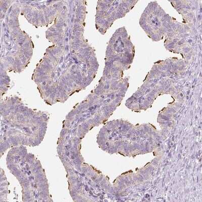 Immunohistochemistry-Paraffin: Lebercilin Antibody [NBP2-48587]