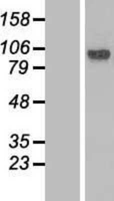 Western Blot: Lebercilin Overexpression Lysate [NBP2-11395]