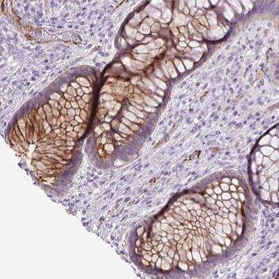 Immunohistochemistry: Lefty-1 Antibody [NBP2-46832]