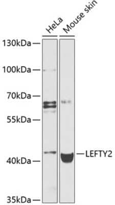 Western Blot: Lefty-2 AntibodyBSA Free [NBP3-03764]