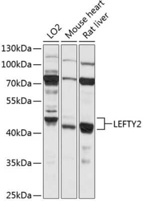 Western Blot: Lefty-2 AntibodyBSA Free [NBP3-03765]