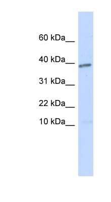 Western Blot: Lefty-1 Antibody [NBP1-59323]