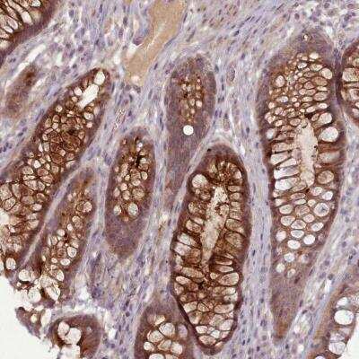 Immunohistochemistry-Paraffin: Lefty-1 Antibody [NBP2-48883]