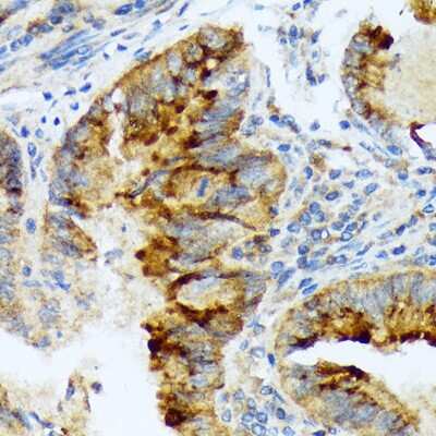 Immunohistochemistry-Paraffin: Lefty1/2 Antibody (2Y10P2) [NBP3-16118]