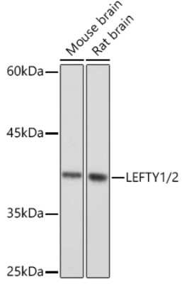 Western Blot: Lefty1/2 Antibody (2Y10P2) [NBP3-16118]