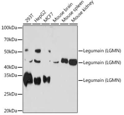 Western Blot: Legumain/Asparaginyl Endopeptidase Antibody (6X5U6) [NBP3-16645]