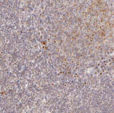 Immunohistochemistry-Paraffin: Legumain/Asparaginyl Endopeptidase Antibody [NBP1-87793]