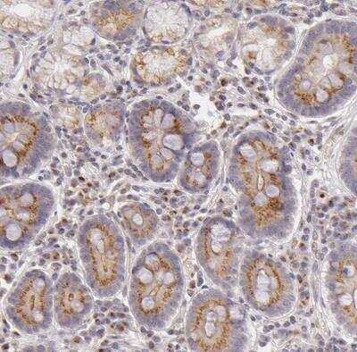 Immunohistochemistry-Paraffin: Legumain/Asparaginyl Endopeptidase Antibody [NBP1-87793]