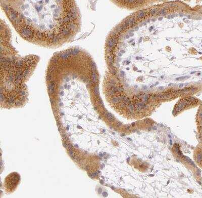 Immunohistochemistry-Paraffin: Legumain/Asparaginyl Endopeptidase Antibody [NBP1-87793]