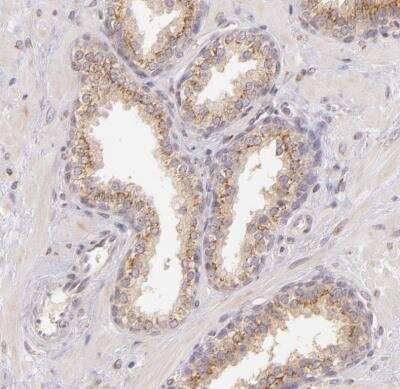 Immunohistochemistry-Paraffin: Legumain/Asparaginyl Endopeptidase Antibody [NBP1-87793]