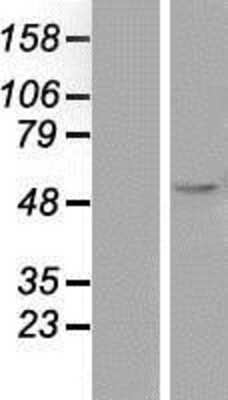 Western Blot: Legumain/Asparaginyl Endopeptidase Overexpression Lysate [NBP2-11310]