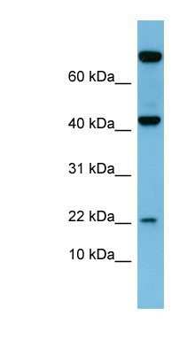 Western Blot: Leptin/OB Antibody [NBP1-59320]