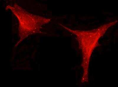 Immunocytochemistry/ Immunofluorescence: Leptin/OB Antibody (002) [NBP2-89345]