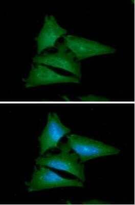 Immunocytochemistry/ Immunofluorescence: Leptin/OB Antibody (7E10) - BSA Free [NBP2-59497]