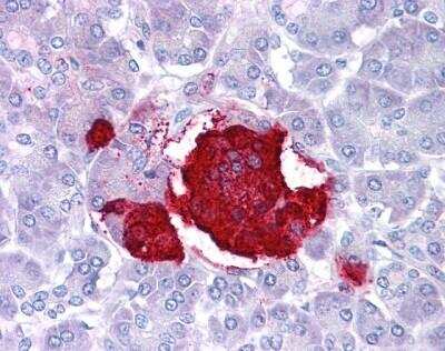 Immunohistochemistry-Paraffin: Leptin/OB Antibody [NBP1-59324]