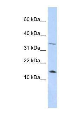 Western Blot: Leptin/OB Antibody [NBP1-59324]