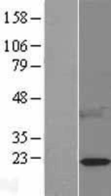 Western Blot: Leptin/OB Overexpression Lysate [NBL1-12489]