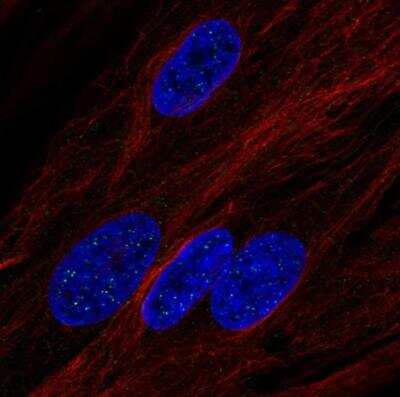 Immunocytochemistry/ Immunofluorescence: Leptin R Antibody [NBP1-85765]