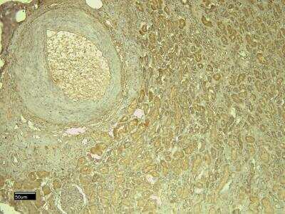 Immunohistochemistry: Leptin R Antibody [NB100-40796]