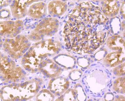 Immunohistochemistry-Paraffin: Leptin R Antibody (JA73-01) [NBP2-66931]
