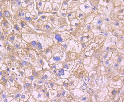 Immunohistochemistry-Paraffin: Leptin R Antibody (JA73-01) [NBP2-66931]