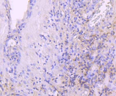 Immunohistochemistry-Paraffin: Leptin R Antibody (JA73-01) [NBP2-66931]