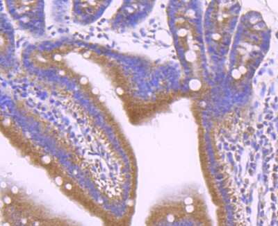 Immunohistochemistry-Paraffin: Leptin R Antibody (JA73-01) [NBP2-66931]
