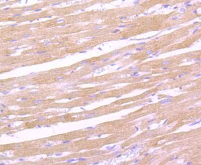Immunohistochemistry-Paraffin: Leptin R Antibody (JA73-01) [NBP2-66931]