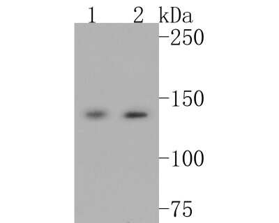 Western Blot: Leptin R Antibody (JA73-01) [NBP2-66931]